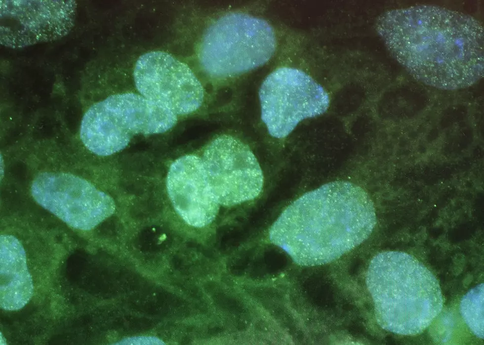 Mayo Reports Advances in Aging Research